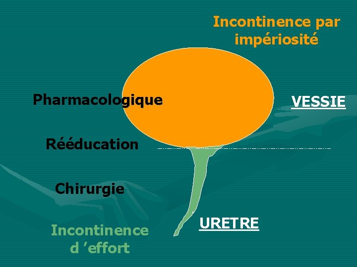 Incontinence par impériosité Pharmacologique VESSIE Rééducation Chirurgie Incontinence d ’effort URETRE 