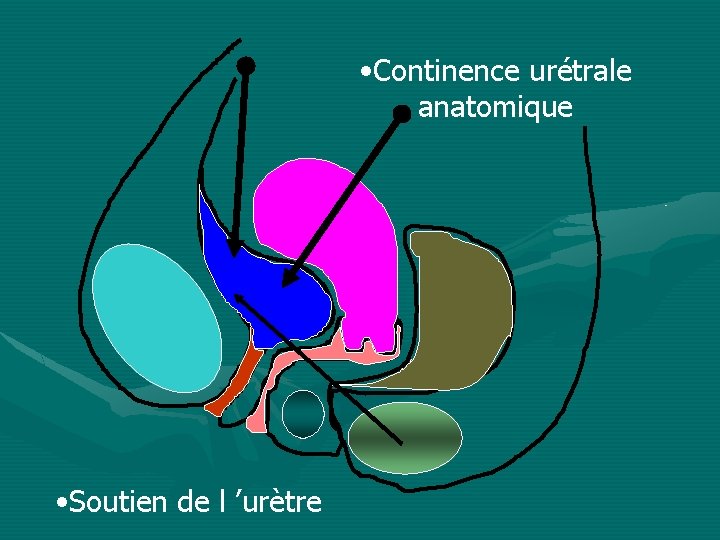  • Continence urétrale anatomique • Soutien de l ’urètre 