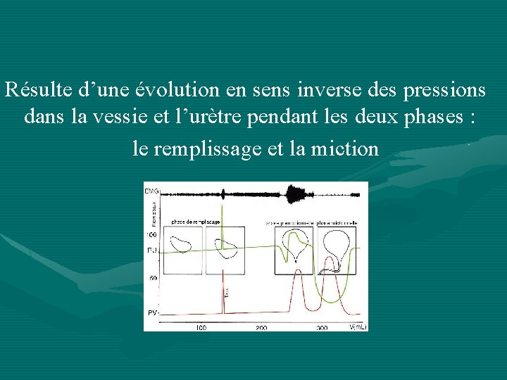 Résulte d’une évolution en sens inverse des pressions dans la vessie et l’urètre pendant