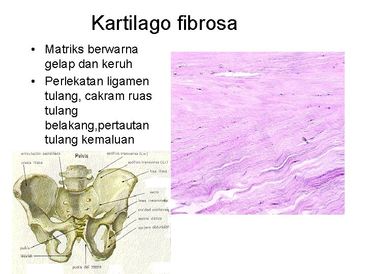 Kartilago fibrosa • Matriks berwarna gelap dan keruh • Perlekatan ligamen tulang, cakram ruas