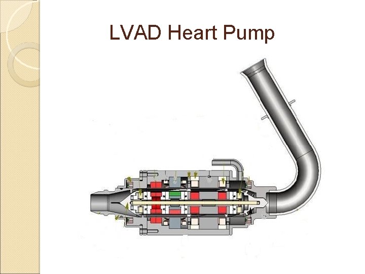 LVAD Heart Pump 
