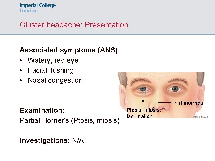 Cluster headache: Presentation Associated symptoms (ANS) • Watery, red eye • Facial flushing •