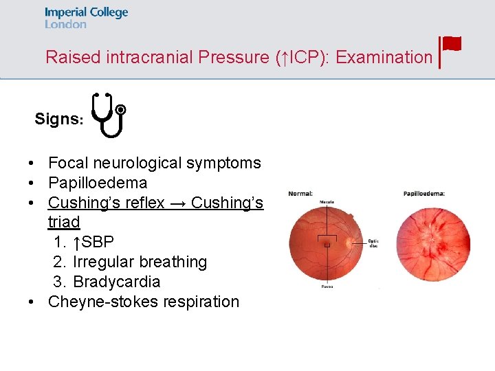 Raised intracranial Pressure (↑ICP): Examination Signs: • Focal neurological symptoms • Papilloedema • Cushing’s