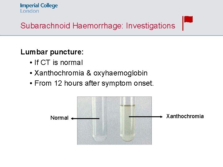 Subarachnoid Haemorrhage: Investigations Lumbar puncture: • If CT is normal • Xanthochromia & oxyhaemoglobin
