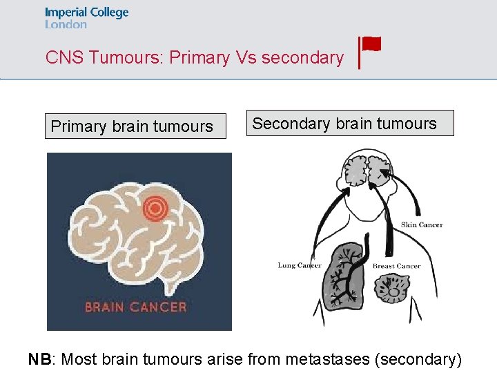 CNS Tumours: Primary Vs secondary Primary brain tumours Secondary brain tumours NB: Most brain