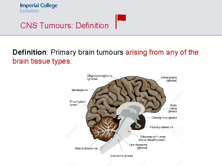 CNS Tumours: Definition: Primary brain tumours arising from any of the brain tissue types.