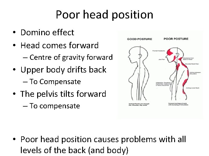 Poor head position • Domino effect • Head comes forward – Centre of gravity