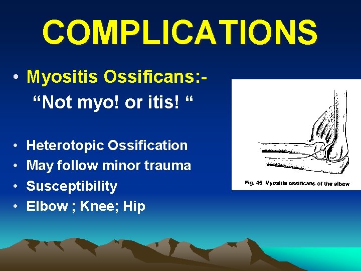 COMPLICATIONS • Myositis Ossificans: “Not myo! or itis! “ • • Heterotopic Ossification May