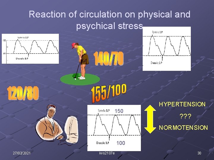 Reaction of circulation on physical and psychical stress HYPERTENSION 150 ? ? ? NORMOTENSION