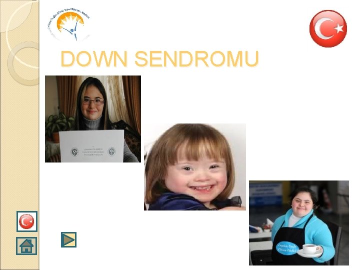 DOWN SENDROMU 