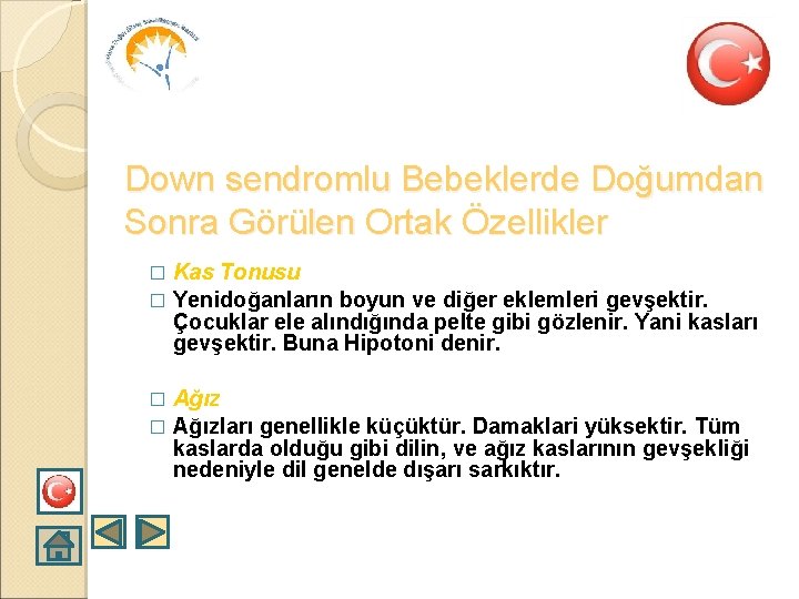 Down sendromlu Bebeklerde Doğumdan Sonra Görülen Ortak Özellikler Kas Tonusu � Yenidoğanların boyun ve