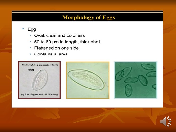 Enterobius Vermicularis Pinworm Or Oxyuris Disease Entrobiasis pinworm