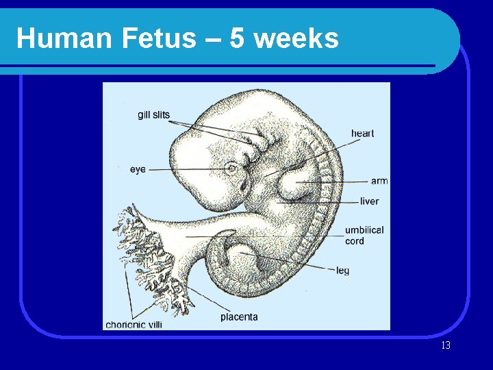 Human Fetus – 5 weeks 13 