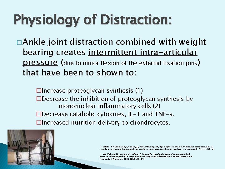 Physiology of Distraction: � Ankle joint distraction combined with weight bearing creates intermittent intra-articular