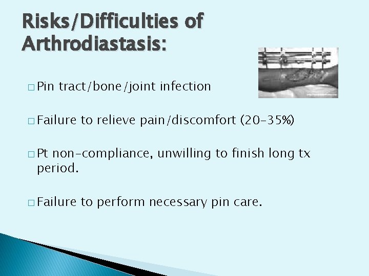 Risks/Difficulties of Arthrodiastasis: � Pin tract/bone/joint infection � Failure to relieve pain/discomfort (20 -35%)
