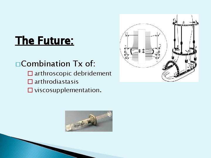 The Future: � Combination Tx of: � arthroscopic debridement � arthrodiastasis � viscosupplementation. 