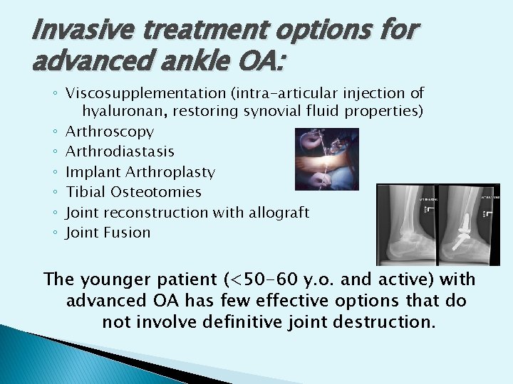 Invasive treatment options for advanced ankle OA: ◦ Viscosupplementation (intra-articular injection of hyaluronan, restoring