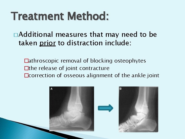 Treatment Method: � Additional measures that may need to be taken prior to distraction