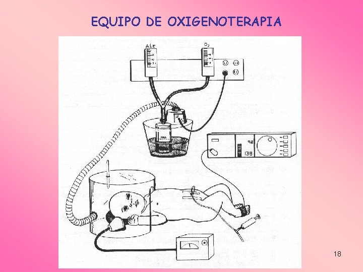 EQUIPO DE OXIGENOTERAPIA 18 