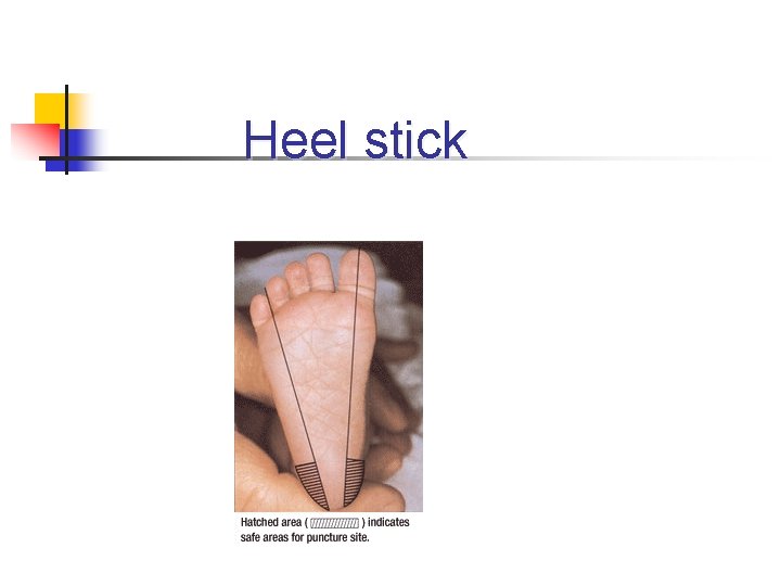 Heel stick 