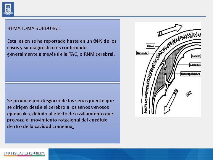 HEMATOMA SUBDURAL: Esta lesión se ha reportado hasta en un 84% de los casos