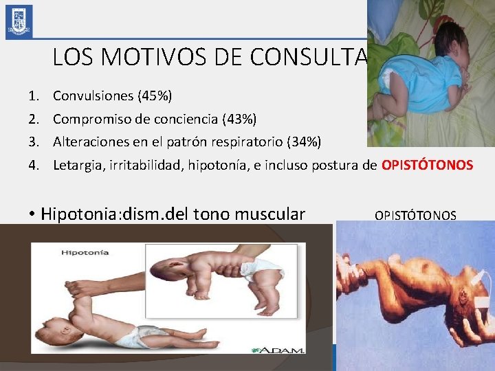 LOS MOTIVOS DE CONSULTA 1. Convulsiones (45%) 2. Compromiso de conciencia (43%) 3. Alteraciones