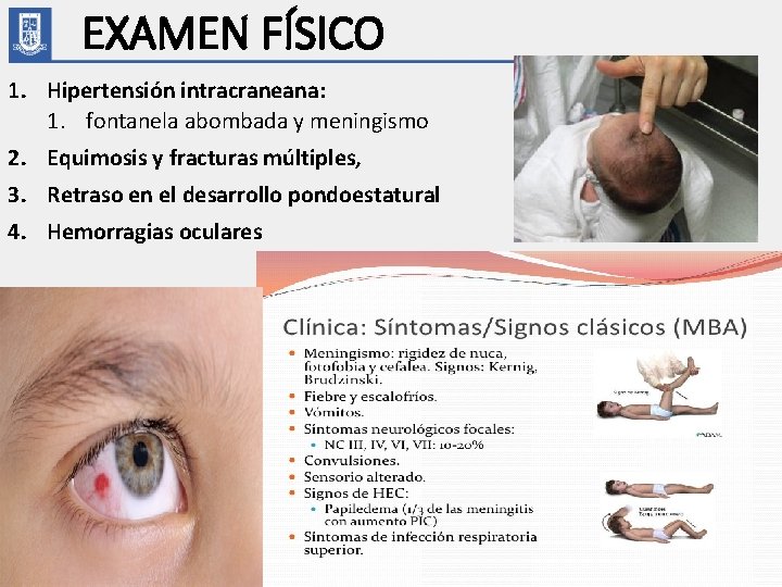 EXAMEN FÍSICO 1. Hipertensión intracraneana: 1. fontanela abombada y meningismo 2. Equimosis y fracturas