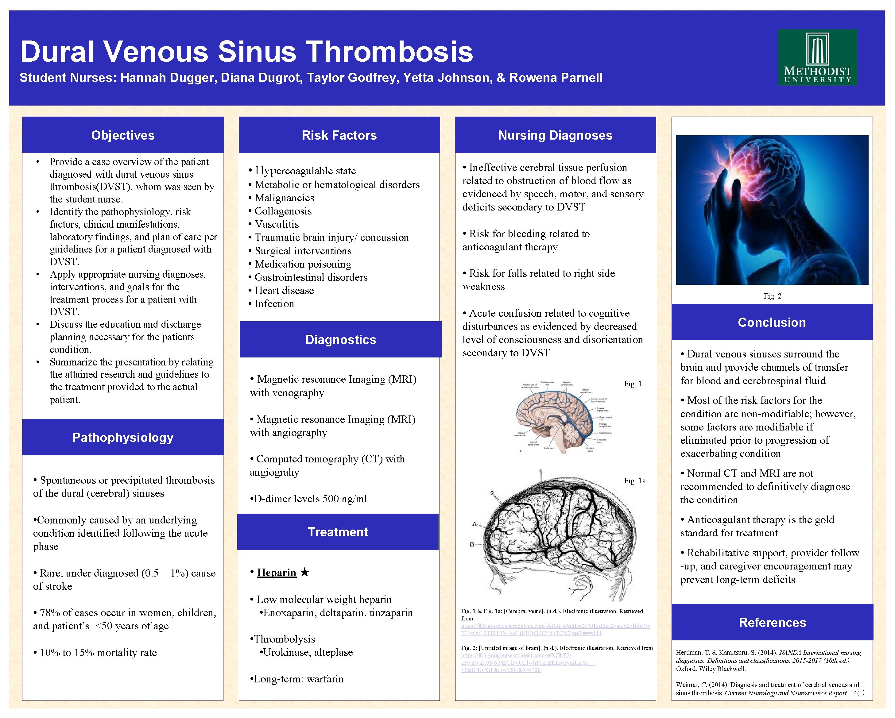 Dural Venous Sinus Thrombosis Student Nurses: Hannah Dugger, Diana Dugrot, Taylor Godfrey, Yetta Johnson,