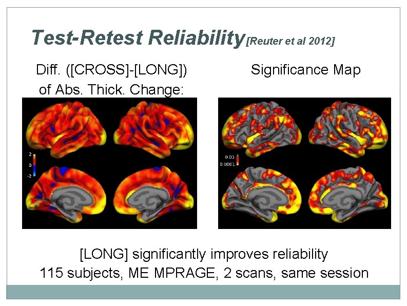 Test-Retest Reliability [Reuter et al 2012] Diff. ([CROSS]-[LONG]) of Abs. Thick. Change: Significance Map