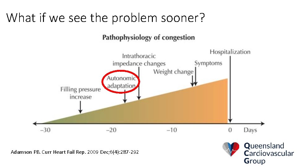 What if we see the problem sooner? Adamson PB. Curr Heart Fail Rep. 2009