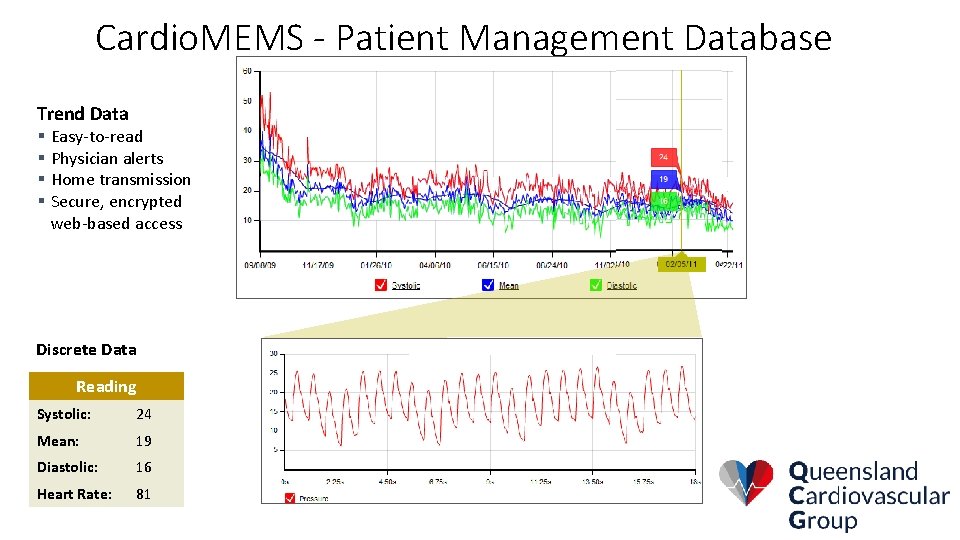 Cardio. MEMS - Patient Management Database Trend Data § Easy-to-read § Physician alerts §