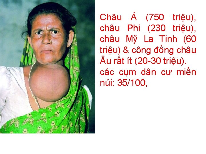 Châu Á (750 triệu), châu Phi (230 triệu), châu Mỹ La Tinh (60 triệu)