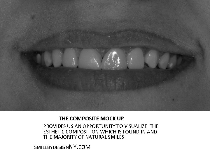 THE COMPOSITE MOCK UP PROVIDES US AN OPPORTUNITY TO VISUALIZE THE ESTHETIC COMPOSITION WHICH