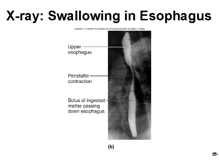 X-ray: Swallowing in Esophagus 25 - 