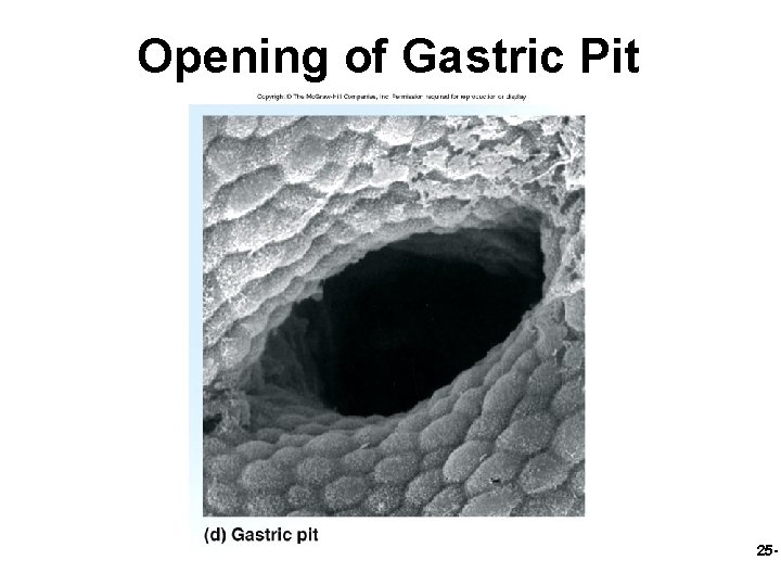 Opening of Gastric Pit 25 - 