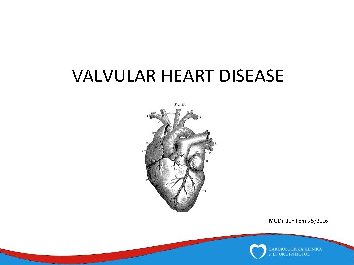 VALVULAR HEART DISEASE MUDr. Jan Tomis 5/2016 