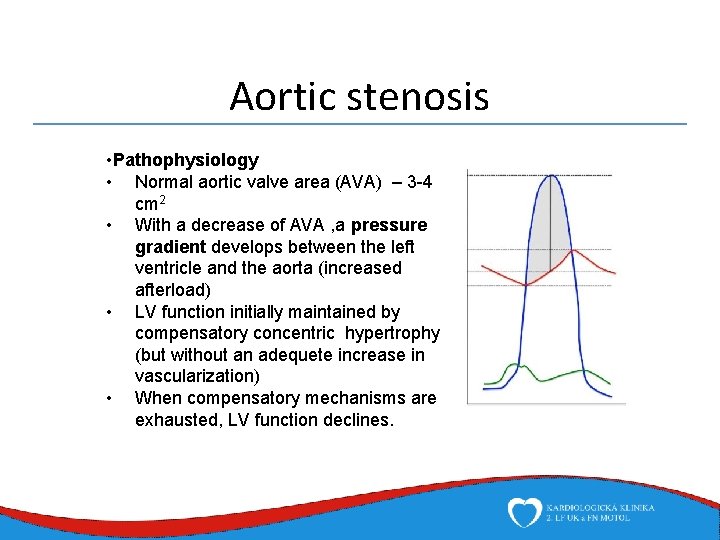 Aortic stenosis • Pathophysiology • Normal aortic valve area (AVA) – 3 -4 cm