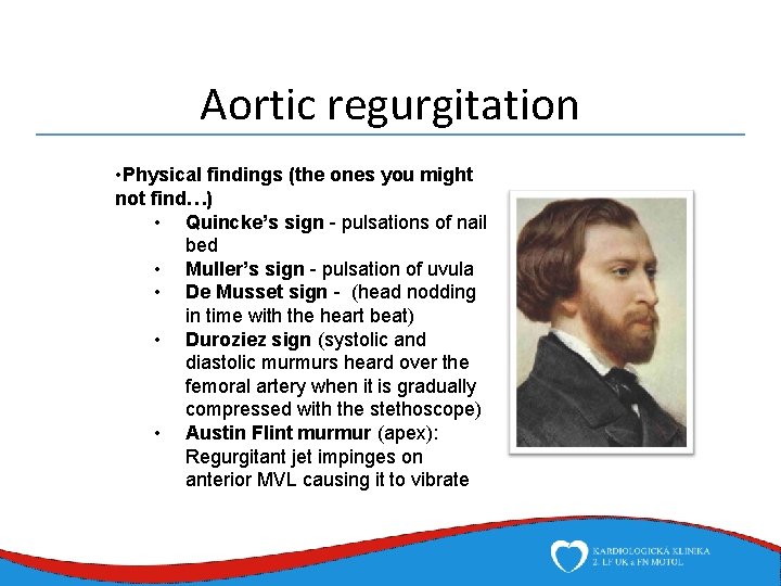 Aortic regurgitation • Physical findings (the ones you might not find…) • Quincke’s sign