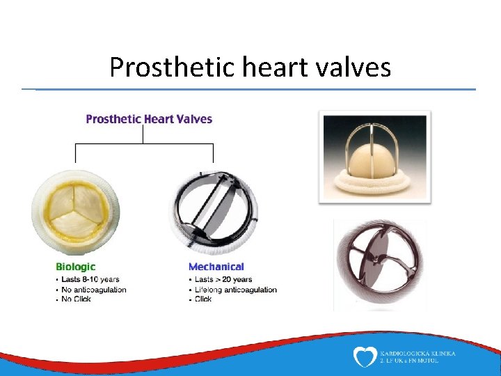 Prosthetic heart valves 