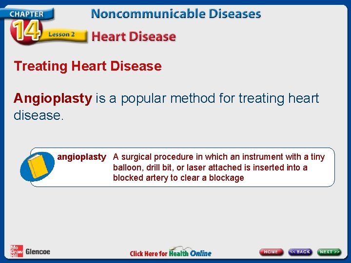 Treating Heart Disease Angioplasty is a popular method for treating heart disease. angioplasty A