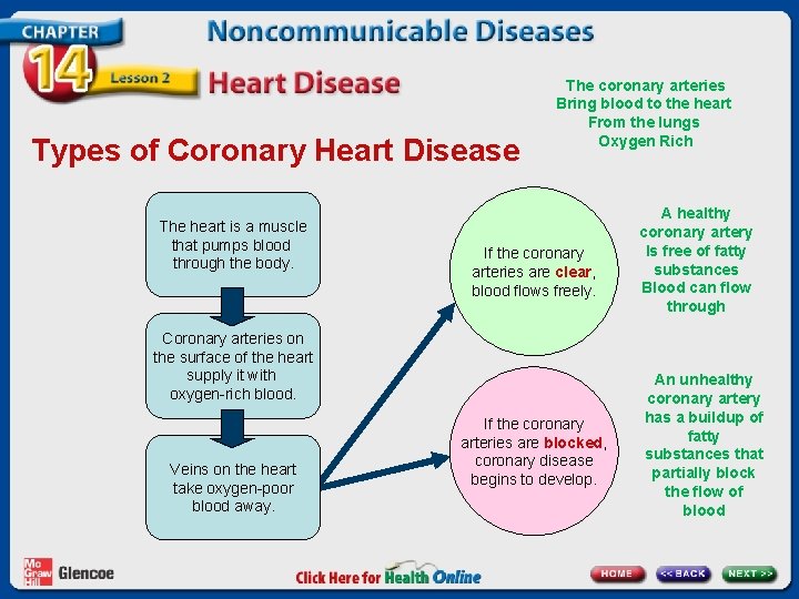 Types of Coronary Heart Disease The heart is a muscle that pumps blood through