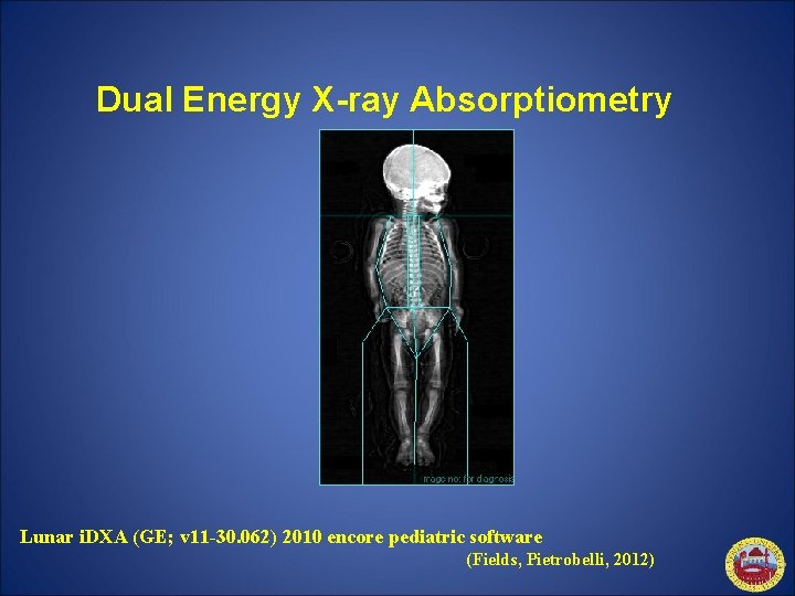 Dual Energy X-ray Absorptiometry Lunar i. DXA (GE; v 11 -30. 062) 2010 encore
