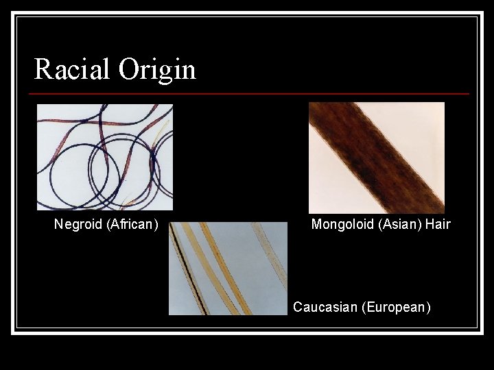Racial Origin Negroid (African) Mongoloid (Asian) Hair Caucasian (European) 