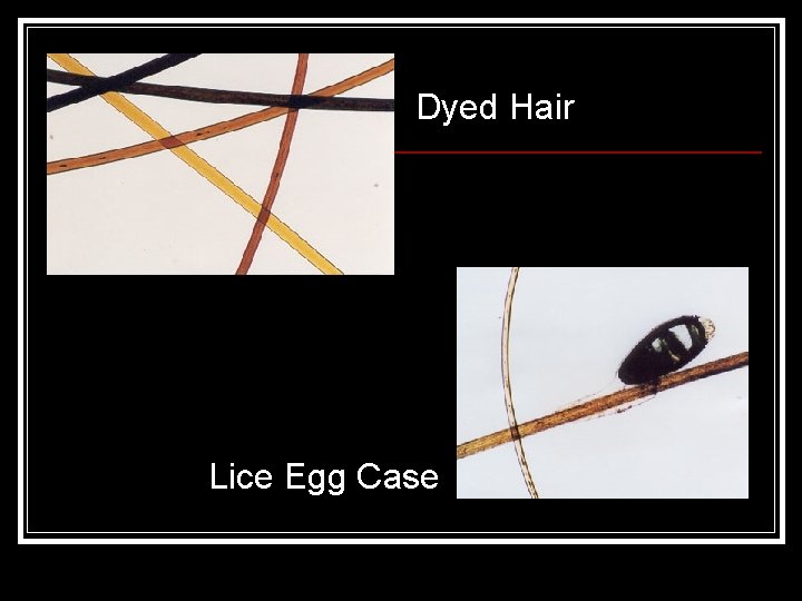 Dyed Hair Lice Egg Case 