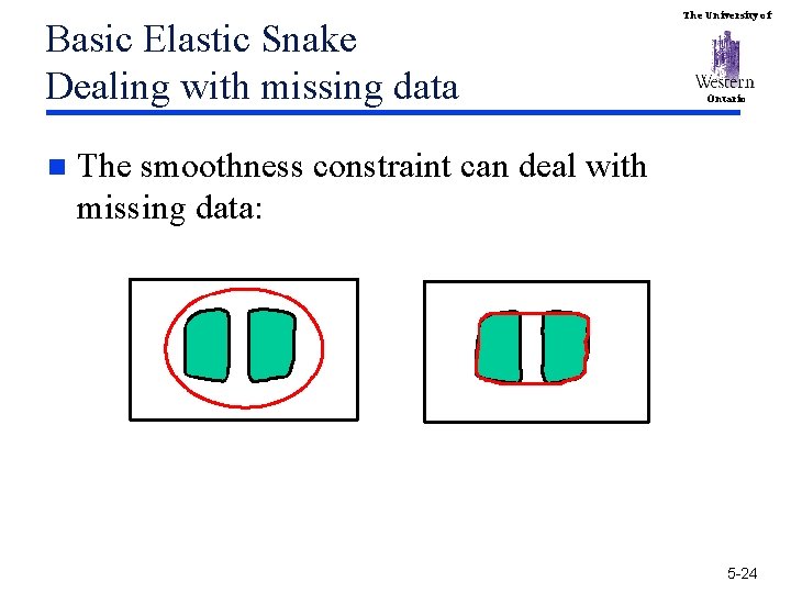 Basic Elastic Snake Dealing with missing data n The University of Ontario The smoothness