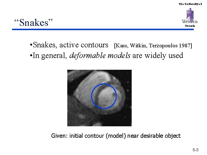 The University of “Snakes” Ontario • Snakes, active contours [Kass, Witkin, Terzopoulos 1987] •