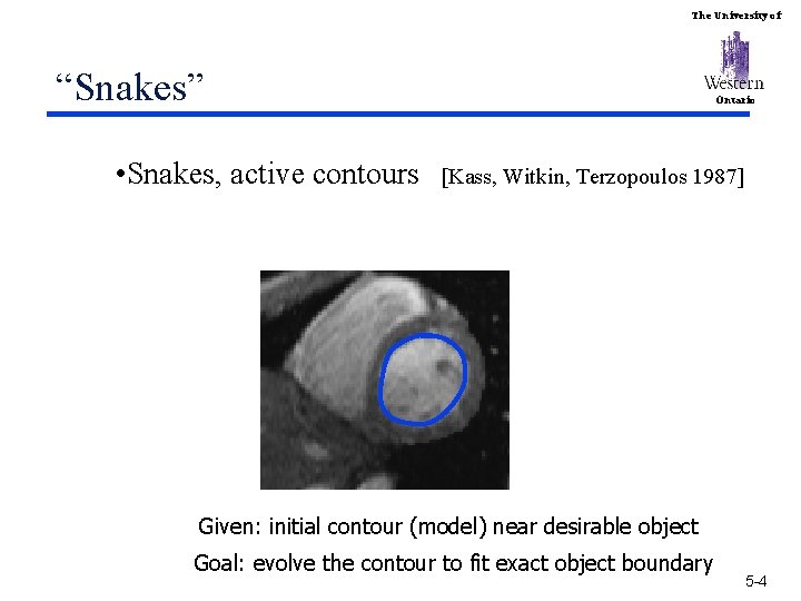 The University of “Snakes” • Snakes, active contours Ontario [Kass, Witkin, Terzopoulos 1987] Given: