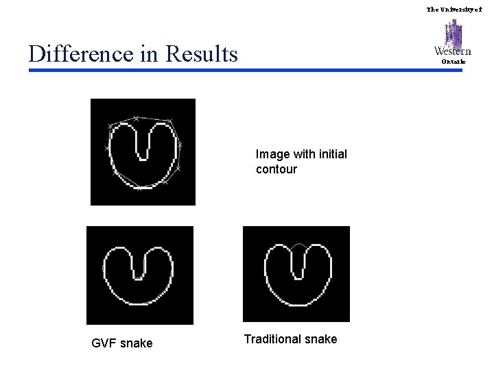 The University of Difference in Results Ontario Image with initial contour GVF snake Traditional