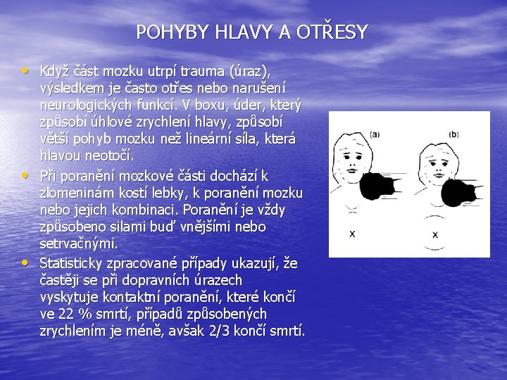 POHYBY HLAVY A OTŘESY • Když část mozku utrpí trauma (úraz), • • výsledkem POHYBY HLAVY A OTŘESY • Když část mozku utrpí trauma (úraz), • • výsledkem