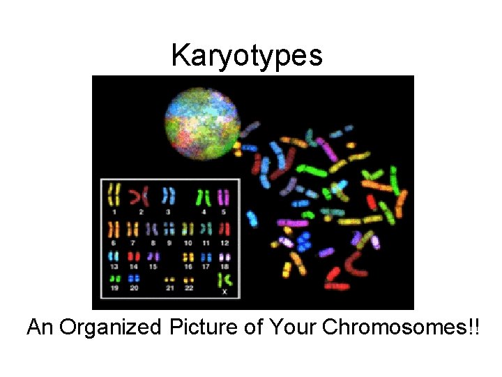 Karyotypes An Organized Picture of Your Chromosomes!! 